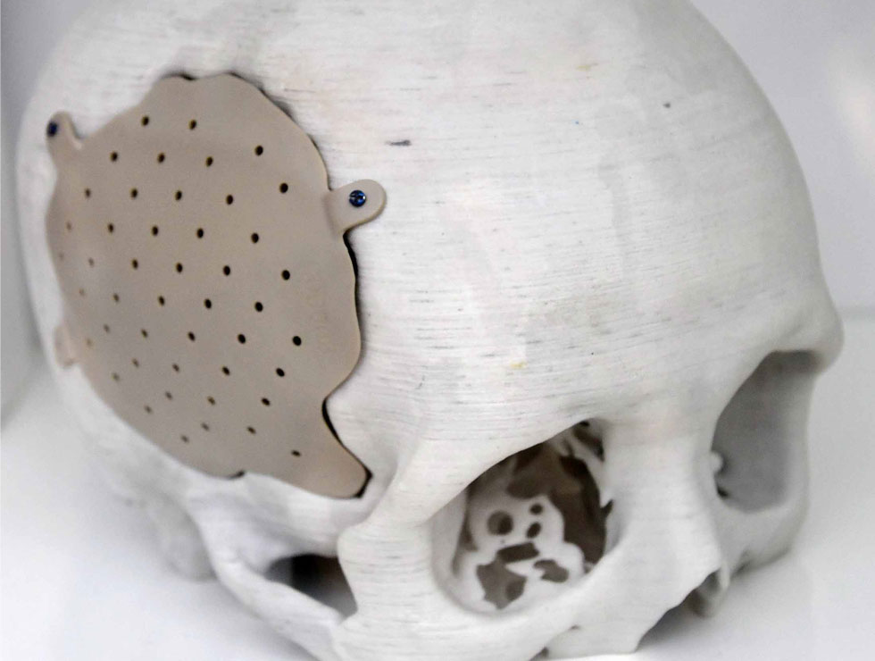 �@������ɫ�ĸ�ˎ��������Ŀ��������3D��ӡ���XĤ��